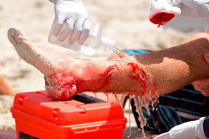 Satellite Beach Shark Attack